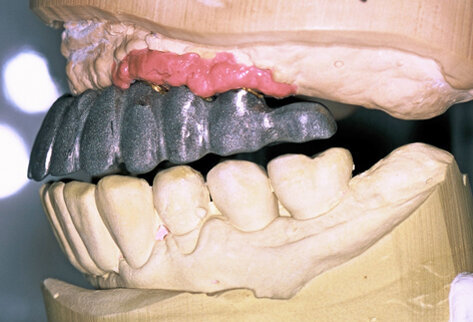 Fig. 11. Milled titanium framework.