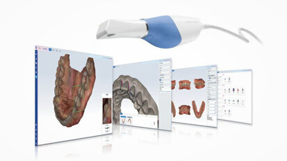 Planmeca Romexis CAD/CAM module takes digital impressions to the next level