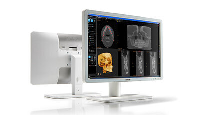 Barco Eonis-Displays: saubere Darstellung von zahnärztlichen Aufnahmen Barco Eonis-Displays: saubere Darstellung von zahnärztlichen Aufnahmen