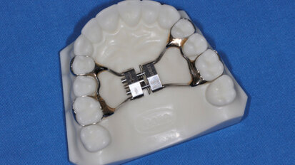 Espansione del mascellare superiore con il Leaf Expander®