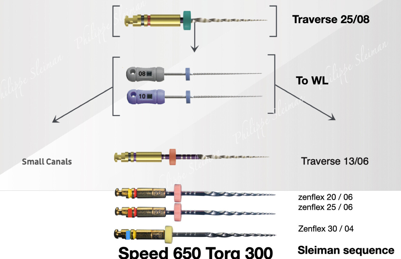 Fig. 4: Technical card for small to medium canals.