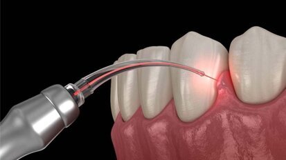 WFLD-APD summons Prof. Arshad Malik as a speaker