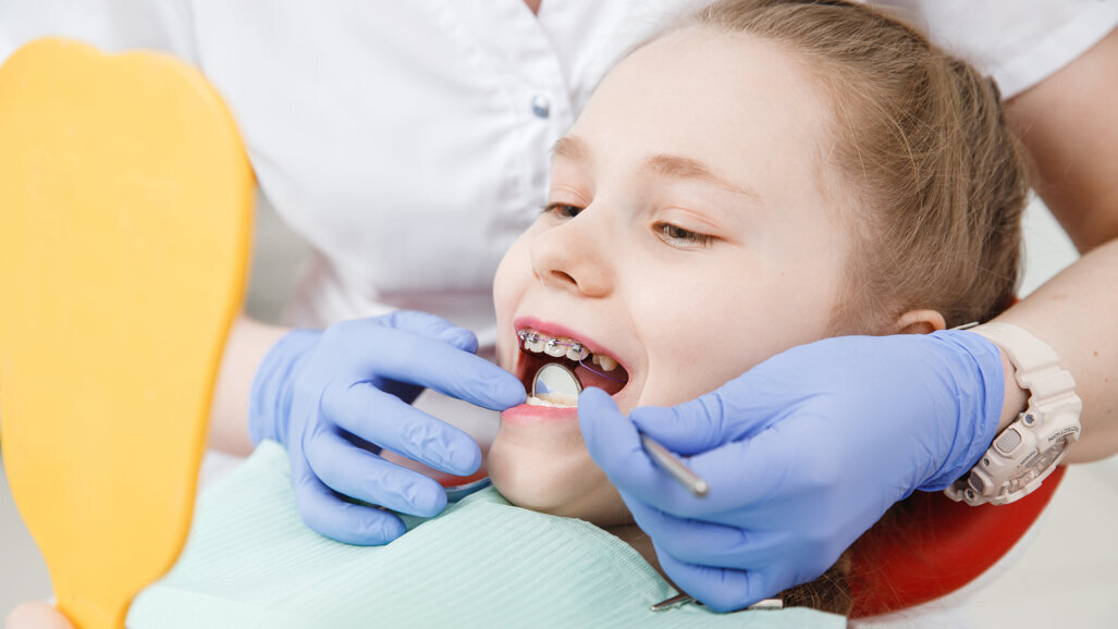 Zahnspangen in der Schweiz häufig finanzielle Belastungsprobe