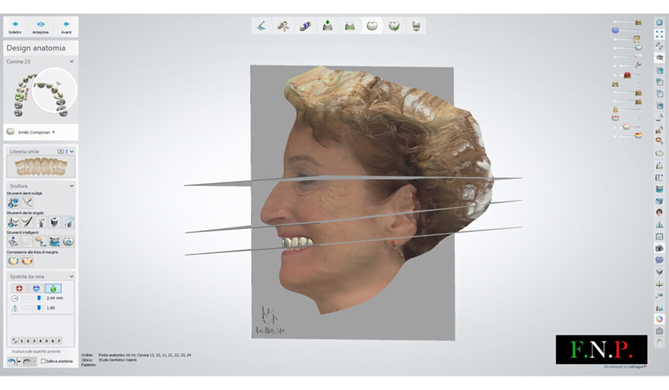 Fig. 12: Aesthetic assessment of the virtual design.