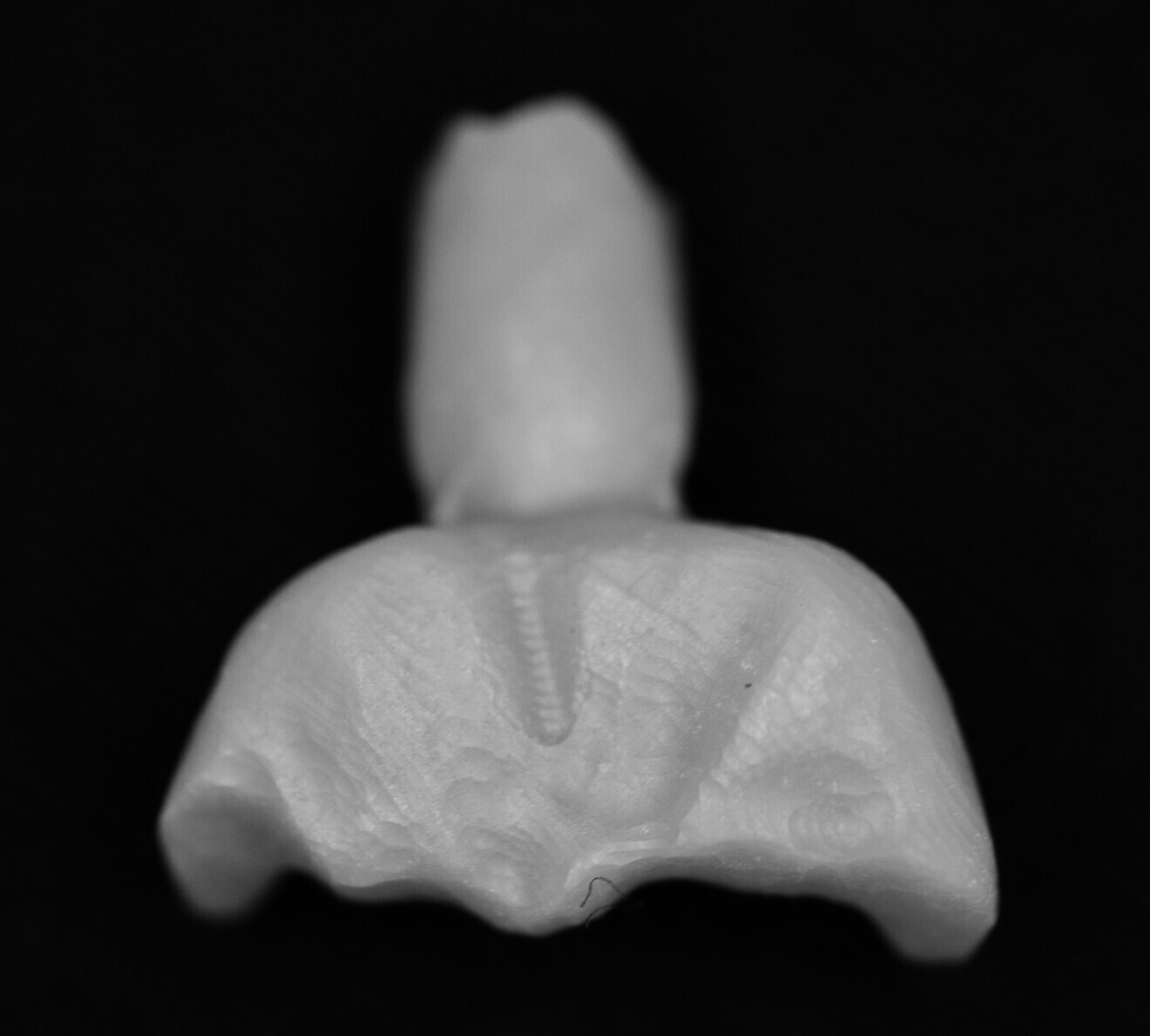 Fig. 12: Zirconia onlay.
