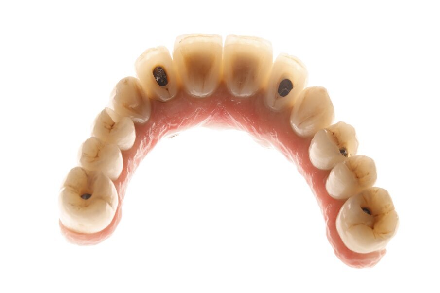 Fig. 18: Definitive restoration.