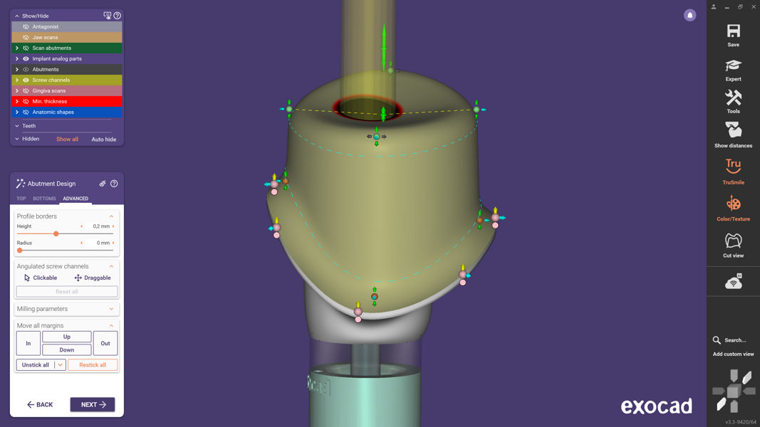 Fig. 9: In the Advanced tab, all supra- and subgingival control points are displayed simultaneously, enabling comprehensive shape adjustments within a single view.
