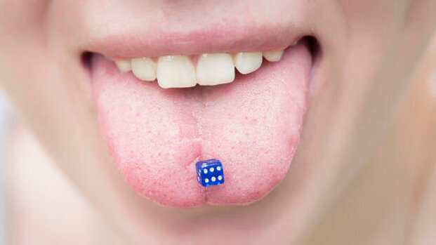 Piercing e gomma da masticare associati ai disordini temporo mandibolari