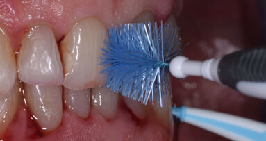 L'efficacia del controllo del biofilm batterico: quali livelli di attenzione?