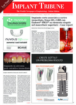 Implant Tribune Italy No.2, 2020 Implant Tribune Italy No.2, 2020