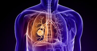 Atemtest soll Krebserkrankung erkennen