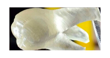 Stampati e senza carie: i nostri denti del futuro