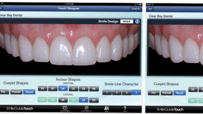 Right ‘touch’ helps patients envision new smile Right ‘touch’ helps patients envision new smile
