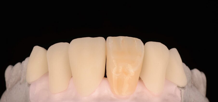 Fig. 23: Application of the GC Initial Spectrum Stains.