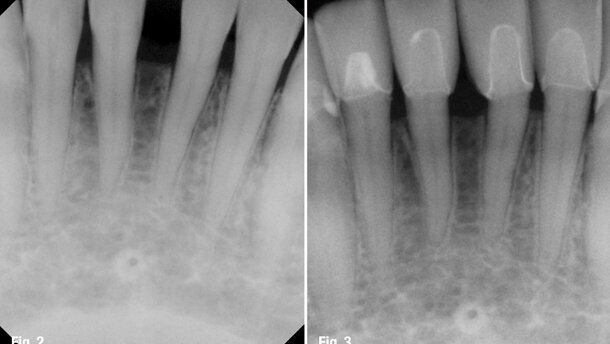 The importance of gingival health in a functional cosmetic case