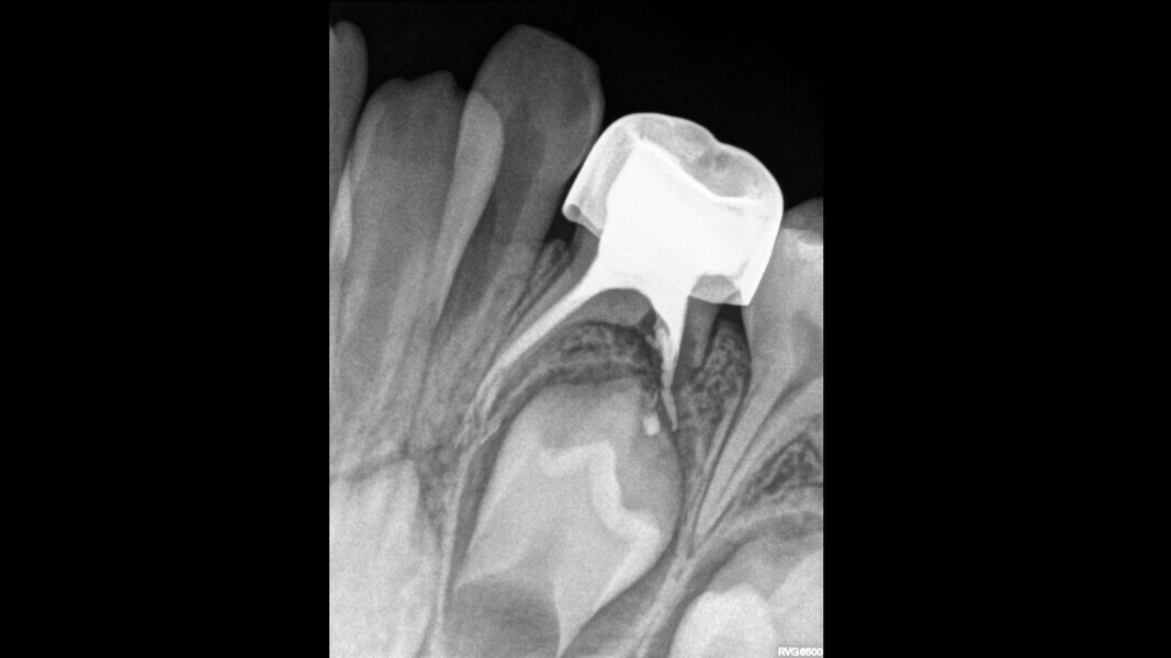 Fig. 17: Thirty-month control.