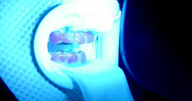 La blancorexia o la obsesión por los dientes blancos