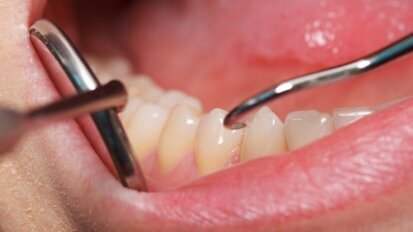 Verzekeraar geeft gratis mondzorgadvies