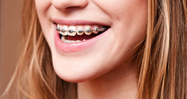 App van promovenda zorgt voor betere mondhygiëne beugelende tieners