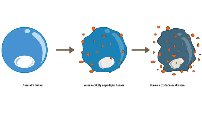 „Souvislost mezi onemocněním dutiny ústní a oxidačním stresem není stále příliš známa“