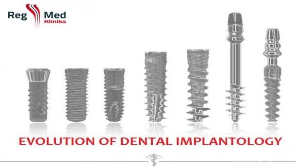 Curriculum for Immediate Loading in Dental Implantology