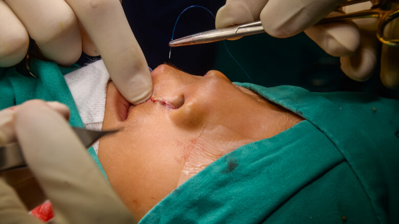 Children with clefts to receive improved oral healthcare