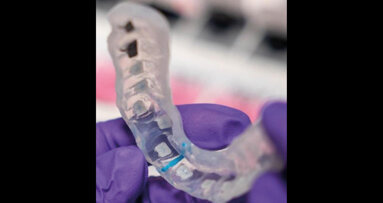 Bonding digitale 3M: vi invitiamo a scoprire le innovazioni per un bonding ortodontico preciso ed efficiente