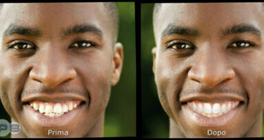 Projetar um novo sorriso a partir de uma foto facial