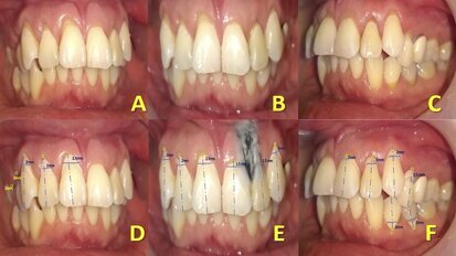 La línea de la belleza del rostro