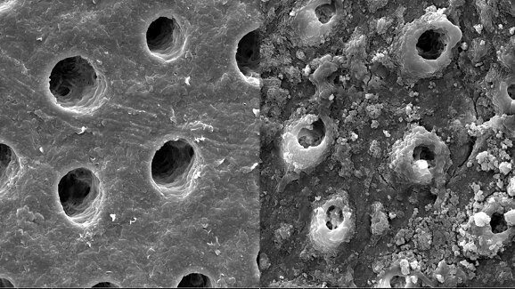 How dental sensitivity can be improved with BioMinF