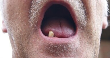 “Zonder voortanden is het lastig solliciteren”