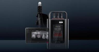 A new era of chairside restorations: “Midas is the first of its kind”