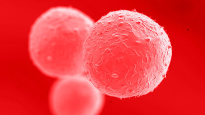 Matične ćelije iz koštane srži presađene u vilicu pacijenta