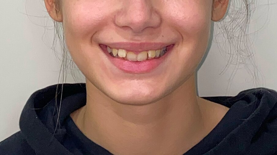 Fig. 2_Viso sorriso pre-trattamento.