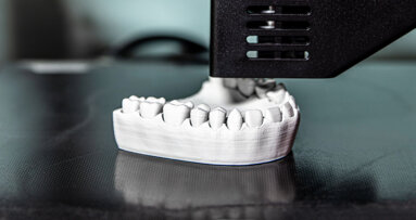 3D printing moves closer to definitive restorations