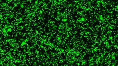 Слюнчените муцини играят важна роля в борбата с кариесите