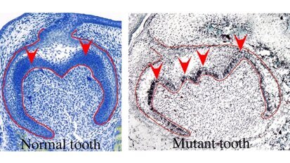 Notwendiges Gen für die Zahnbildung entdeckt