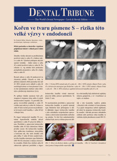 DT Czech and Slovak Republic No. 1, 2015