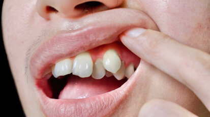 China emergindo como chave no mercado ortodôntico e de alinhadores claros