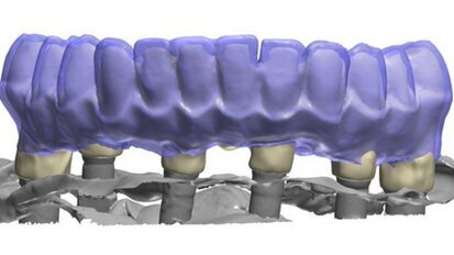 Il parere dell’Odontotecnico sui flussi di lavoro nei laboratori