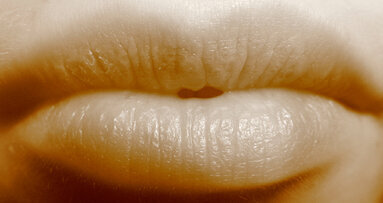 AITEB: per il Consiglio superiore della sanità il botulino non si fa dal dentista