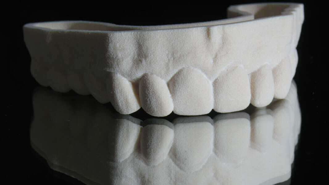 Figura 5. Modelo de trabajo estereolitográfico.