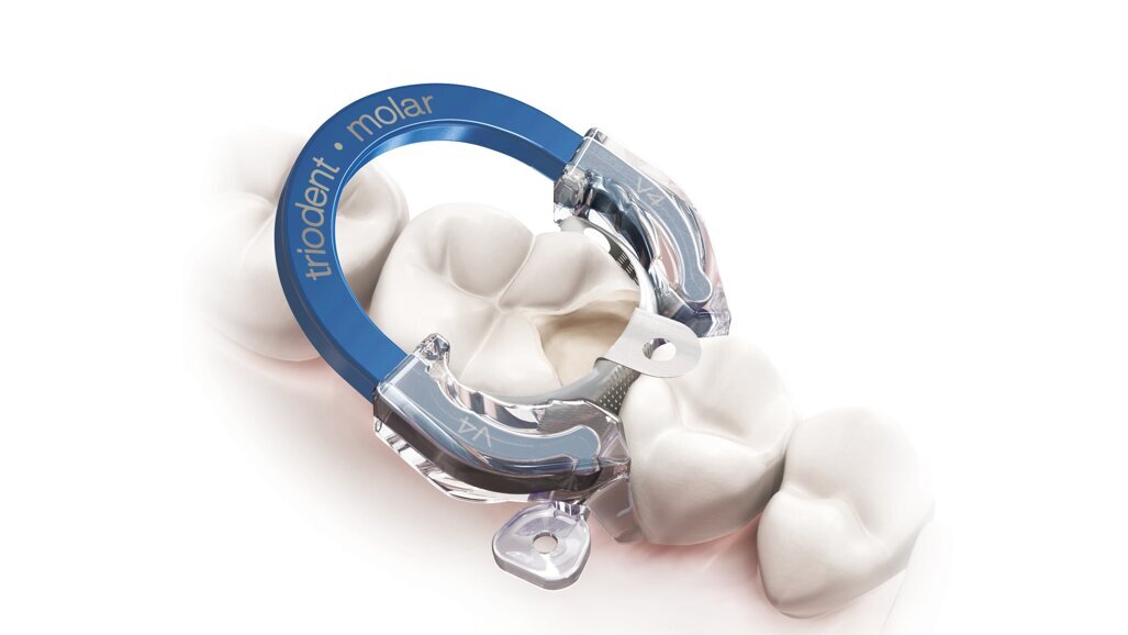 Νέο V4 Sectional Matrix System