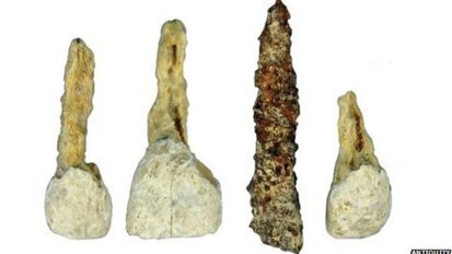 Oudste tandprothese in West-Europa ontdekt