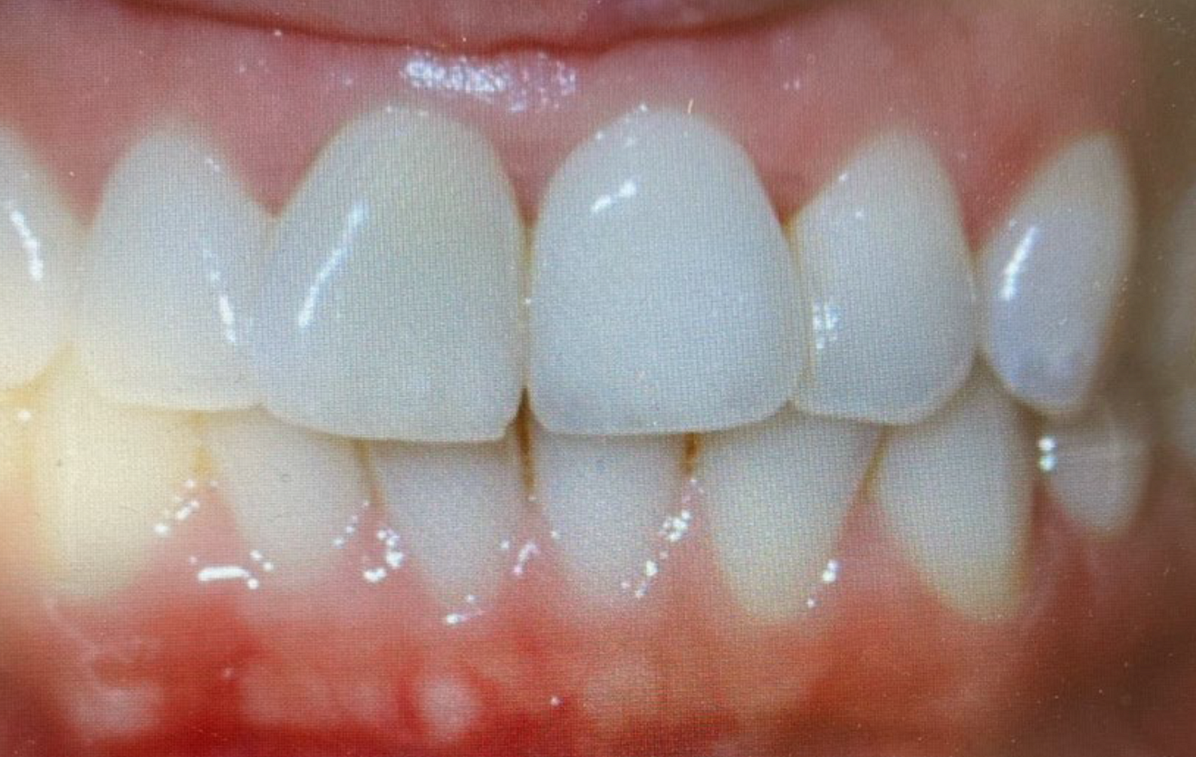 .. and clinical view at the seven-year follow-up (h).