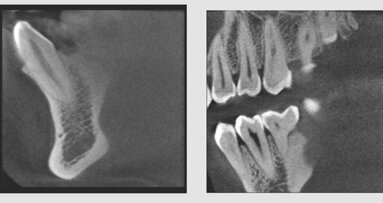 Suni Medical Imaging announces 3-D-only cone beam system