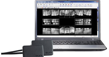 Digital X-ray sensor achieves lowest radiation exposure levels