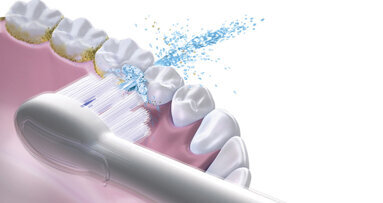 Waterpik Sonic-Fusion Professional