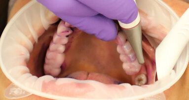 La contaminazione batterica dell’aria nella sala operativa durante un trattamento AIRFLOW