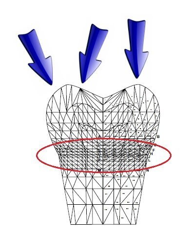 Fig. 1: Finite element analysis when the tooth is loaded under function by either longitudinal or off-axis forces leads to concentration of those forces in the cervical region of the tooth. Image courtesy of Dr. Gene McCoy. (Photo provided by Dr. Gregori M. Kurtzman)